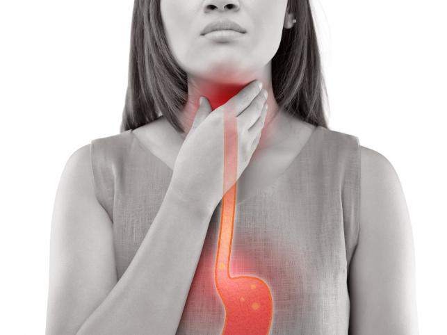 Reflux Fotó:123rf.com - PROAKTIVdirekt Életmód magazin és hírek - proaktivdirekt.com