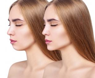 Arc változása Fotó:123rf.com - PROAKTIVdirekt Életmód magazin és hírek - proaktivdirekt.com